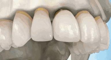 牙科诊所里你不知道的事,口腔医生提醒