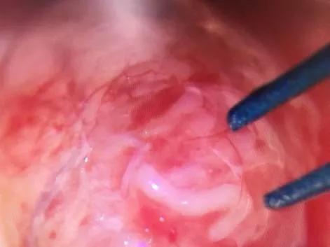 一文看懂医学影像科,一文读懂肝脏超声