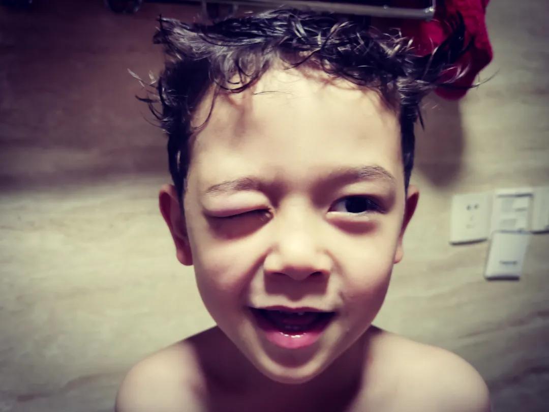 儿砸！为何我磨破嘴皮说安全，你还是上天入地、眼肿、牙碎