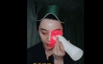 19岁姑娘打溶脂针,女子打美容针脸肿