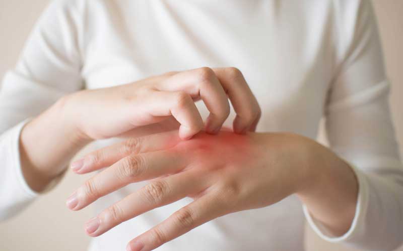 麻疹解释,麻疹怎么解释