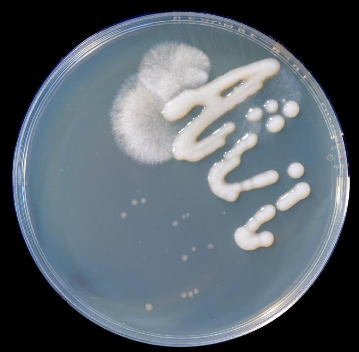 治灰指甲要验血吗,医院检查灰指甲挂号什么科