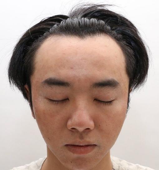 网友：张碧晨插足成小三？华晨宇“实锤”整容“？律师起诉？