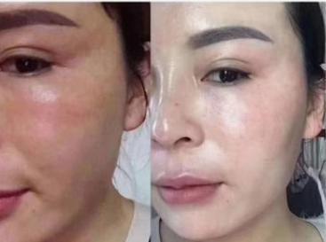 胎盘前壁后壁文案,胎盘的文案