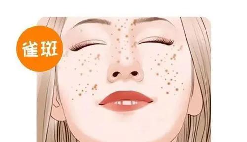年龄大了脸上的斑怎么才能去掉啊,年龄大了脸上斑点怎么去除或淡化
