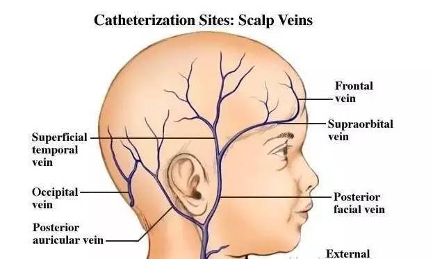 宝宝怎么保护留置针,静脉留置针的使用护理ppt