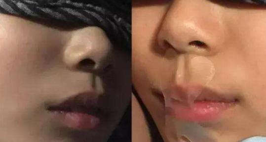 孩子用嘴巴呼吸贴嘴,孩子哭闹被妈妈用胶布封住嘴