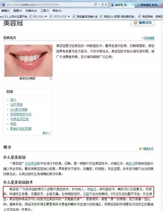 美容冠是什么样,美容冠是什么样的