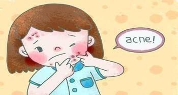 亲测有效祛痘印小妙招,真正可以消除痘印的方法