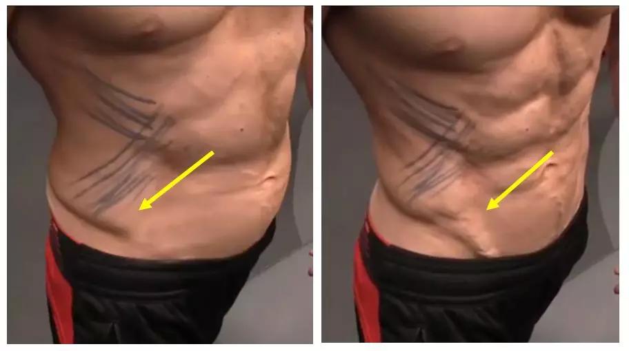 能减掉腰间赘肉吗,怎么减掉腰间赘肉