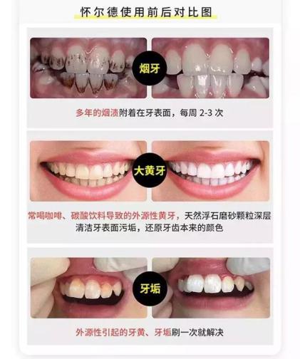 倪妮泳装露齿笑又迷倒一票人！湿法风格突然走火，牙白才敢这样玩