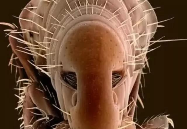 用显微镜看寄生虫是什么样子,显微镜看寄生虫需要放大多少倍