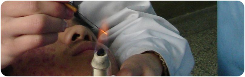 中医火针疗法教学视频,火针操作手法