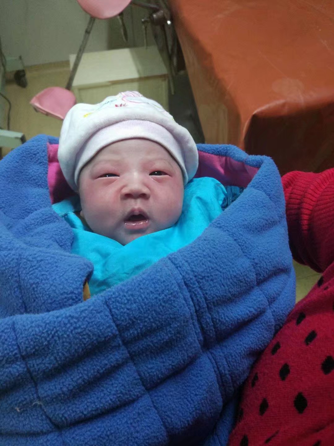 宝宝血管瘤治愈,血管瘤宝宝治疗