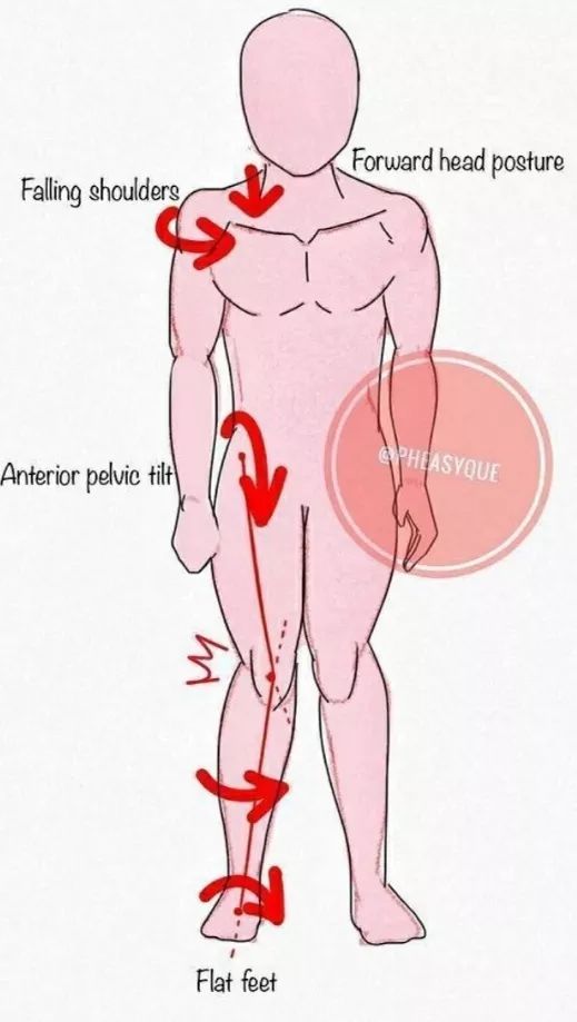 跑步跑到足跟痛，运动生涯要报废？