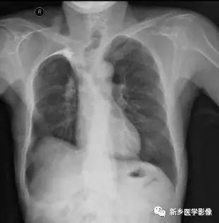 肺部基础免疫,肺基础疾病有哪些