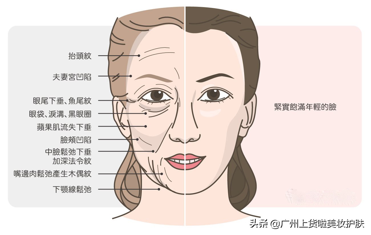 法令纹比较深最有效的办法,法令纹的种类及改善方法