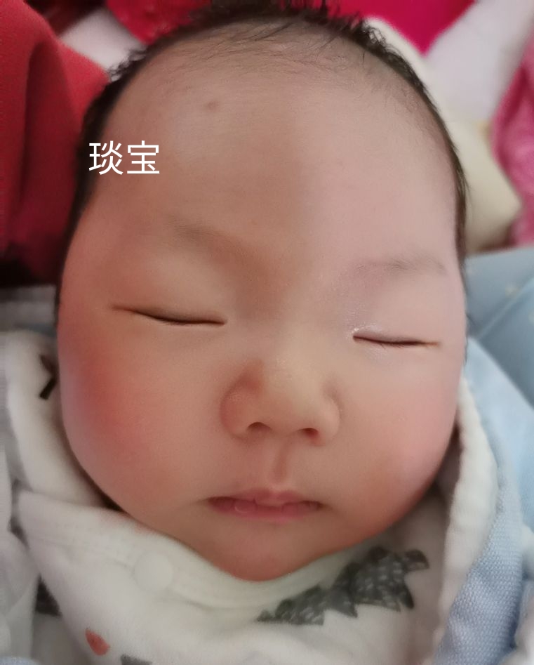 皮肤受伤疤痕修复,疤痕体质受伤后怎么不留疤