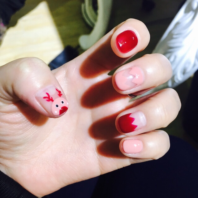 为什么手指甲比头发长得快,为什么手指甲比别人的小