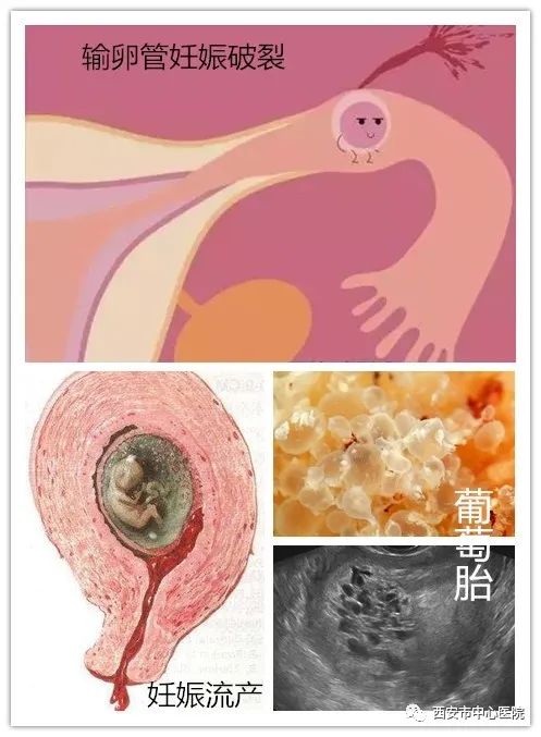 三八妇女节放假温馨提示,三八妇女节抗疫