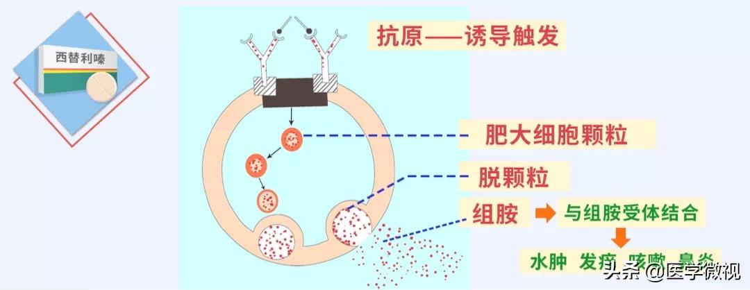 过敏鼻炎用氯雷他定还是西替利嗪,过敏吃氯雷他定还是西替利嗪快些