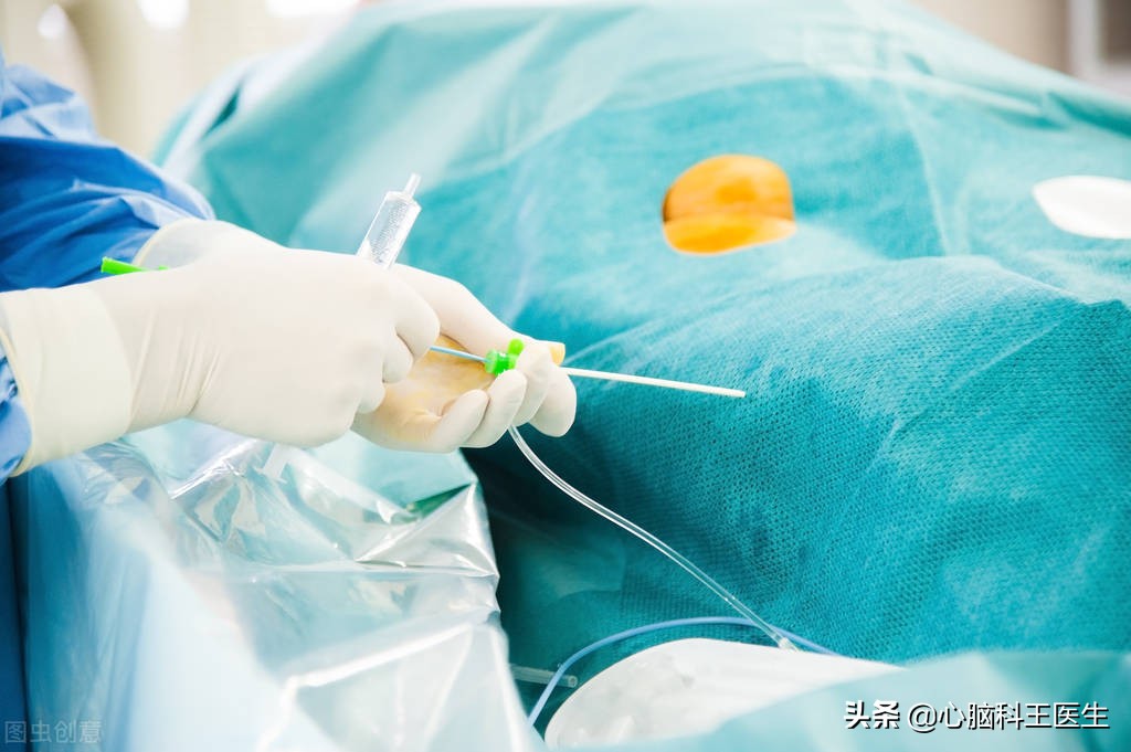 房颤的类型有哪些及治疗方法,快速缓解房颤的最好治疗方法