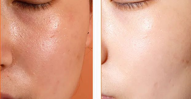 春雨蜂蜜面膜真实测评,春雨蜂蜜面膜用法及功效