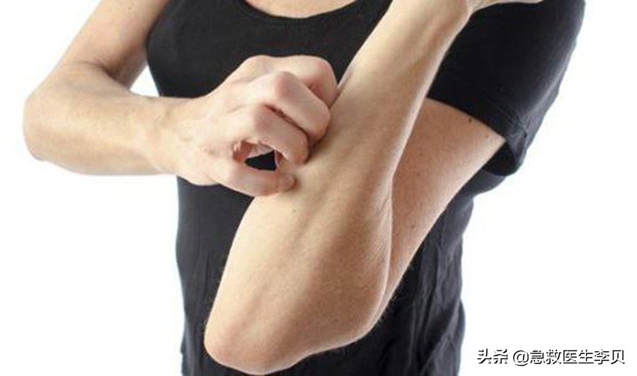 泡温泉裸泡会传染病吗,桑拿为什么不会导致热射病