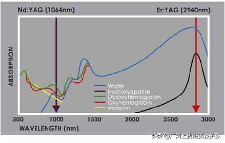 paa美容抗衰和光子嫩肤哪个好,美容光子嫩肤有什么作用