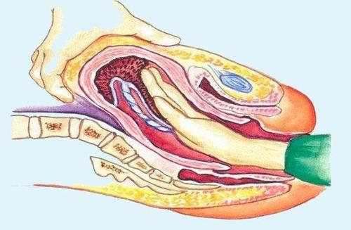 产妇顺产男医生接产,产妇顺利生产但是女儿婆婆怒了