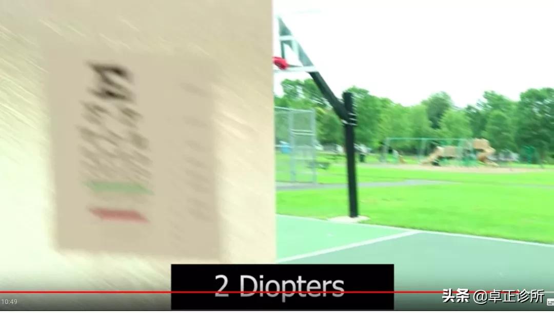 小孩眼睛近视散光怎么改善,眼睛散光近视要怎么改善