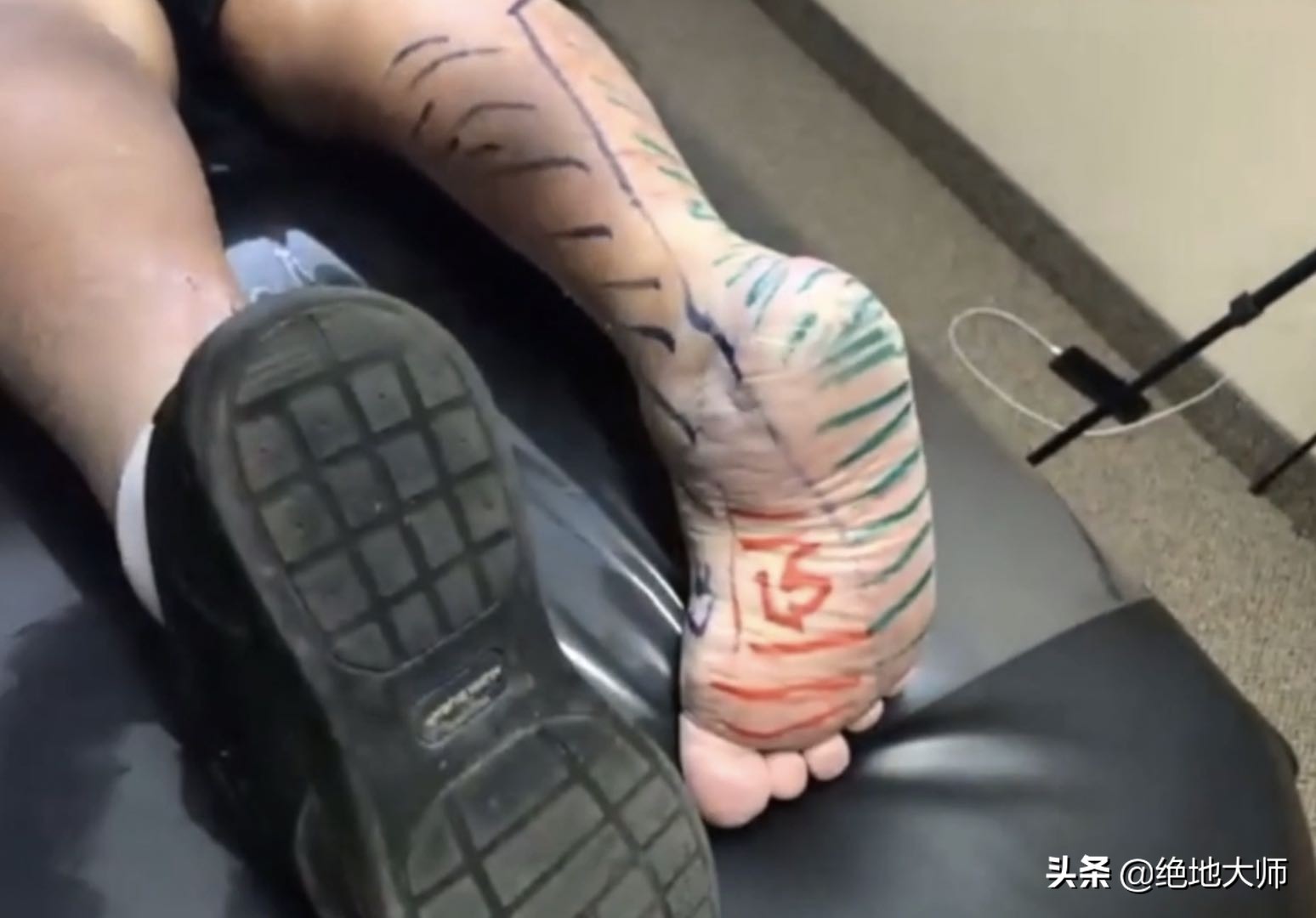 坐骨神经痛怎么治疗康复,坐骨神经疼吃哪种营养神经的药