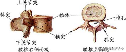 腰椎间盘突出的影像学诊断及治疗,腰椎间盘突出影像学课件