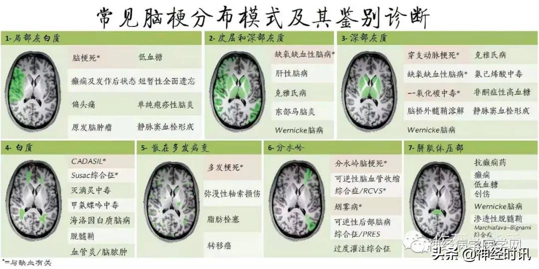 脑卒中的快速识别ppt,脑卒中神经影像学实例解析