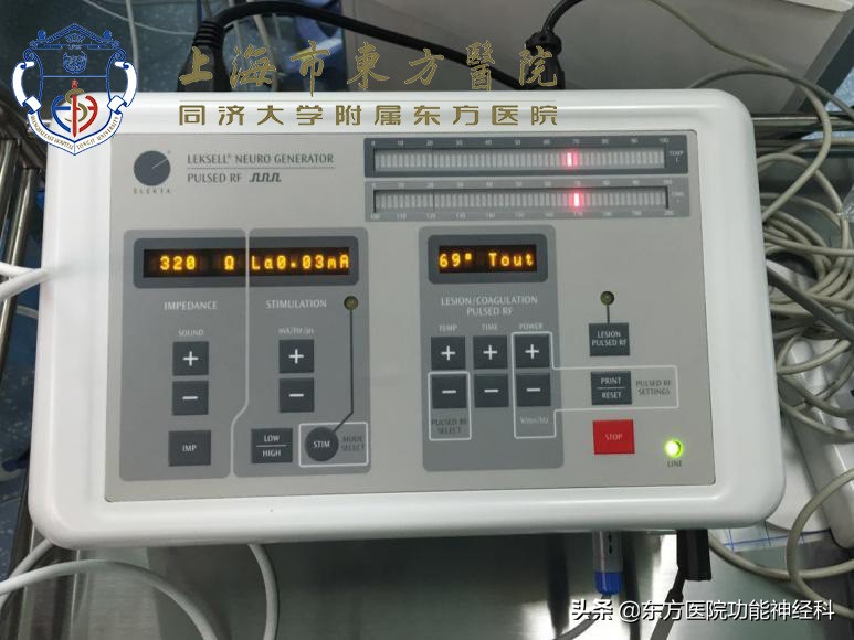 难治性精神病有必要外科手术吗,手术治疗精神病的成功率