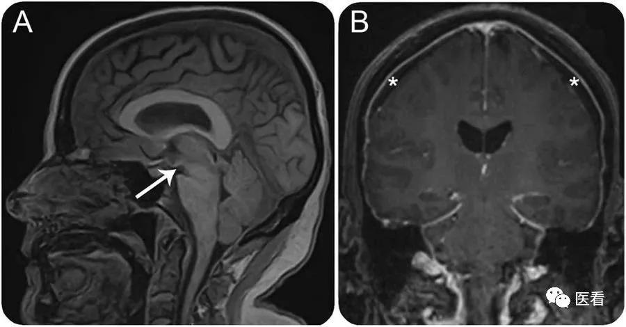 这就是空腹拍片的原因！听医生的话别让他受伤......