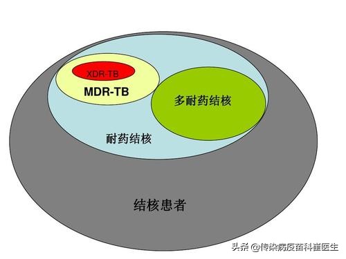 结核病怎么治疗和预防,结核病是从什么时候可以治疗好的