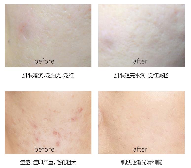 补水喷雾是越喷越干吗,补水喷雾用不好对皮肤