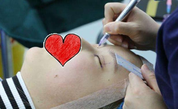 南华博士整形,南华双眼皮手术