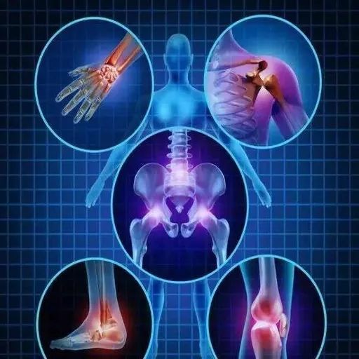 骨关节炎需要输液治疗吗,骨关节炎滑囊炎用什么药