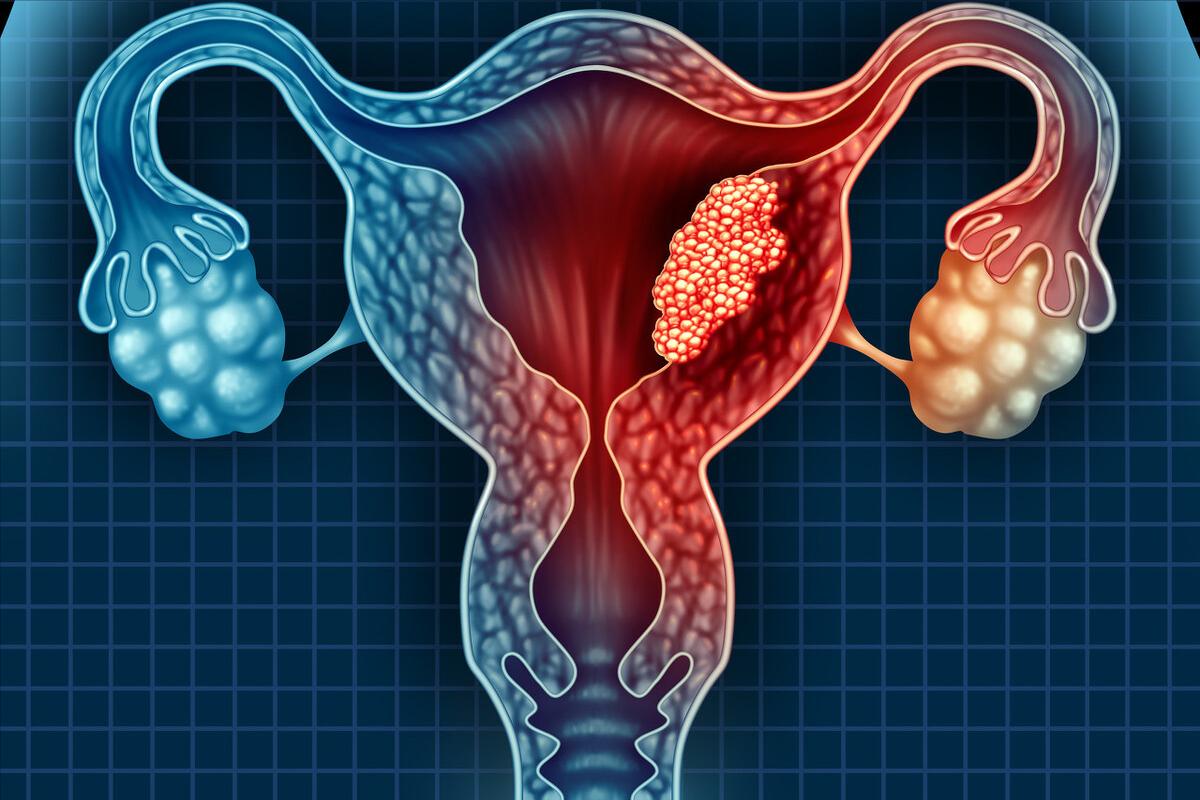 女性雌激素不足骨质疏松,老年女性骨质疏松能吃点雌激素吗