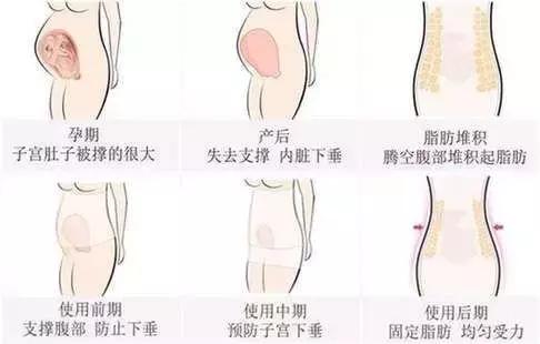 分娩带给宝妈创伤,分娩对产妇的影响