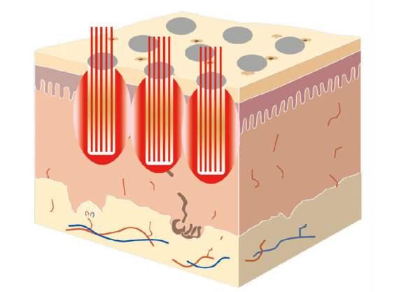 暑期变美变瘦好物推荐,暑假教你如何变美