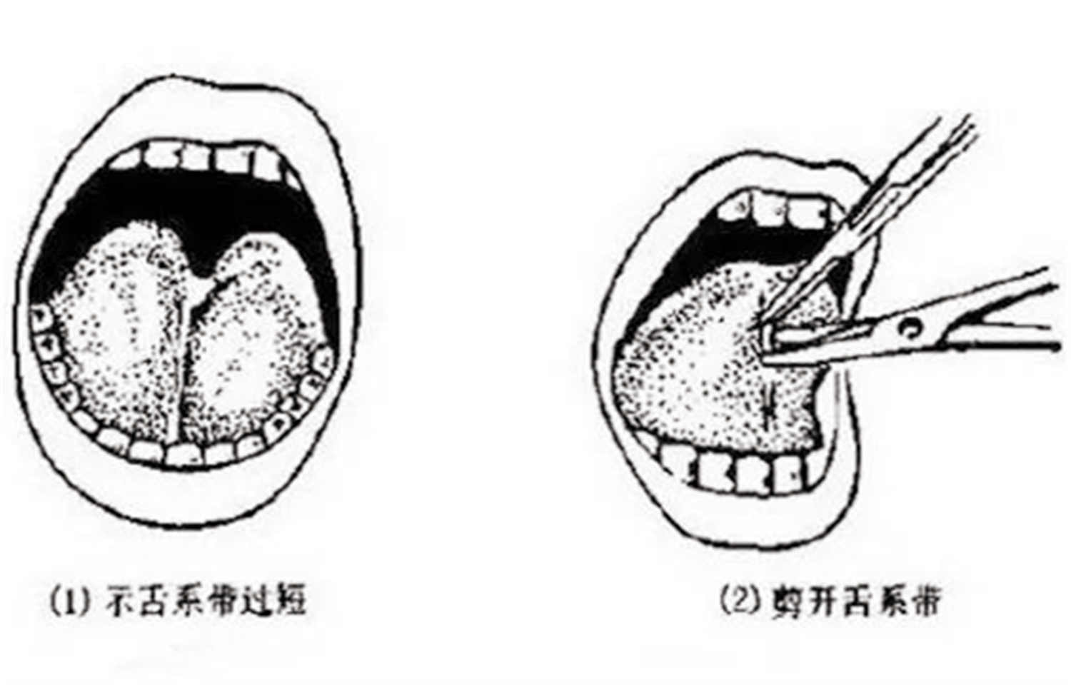 老人给孩子剪舌根的危害,老一辈对孙子的执念