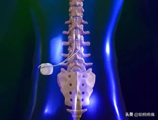 得了带状疱疹疼痛怎么办,带状疱疹有一点痛是不是快好了