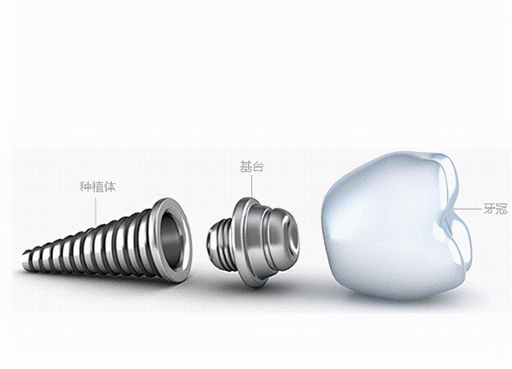 牙齿缝隙大做了烤瓷牙后悔了,烤瓷牙牙齿缺失又不想种牙怎么办