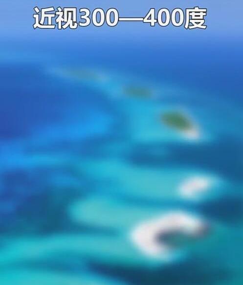 近视究竟是如何发展的,近视到底多可怕