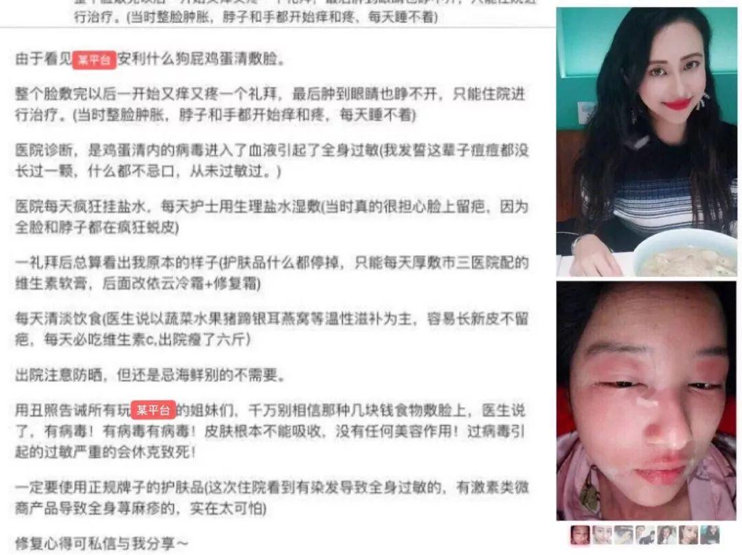 这些不靠谱的护肤方式你可别乱试,这些烂脸护肤误区你可千万不要犯