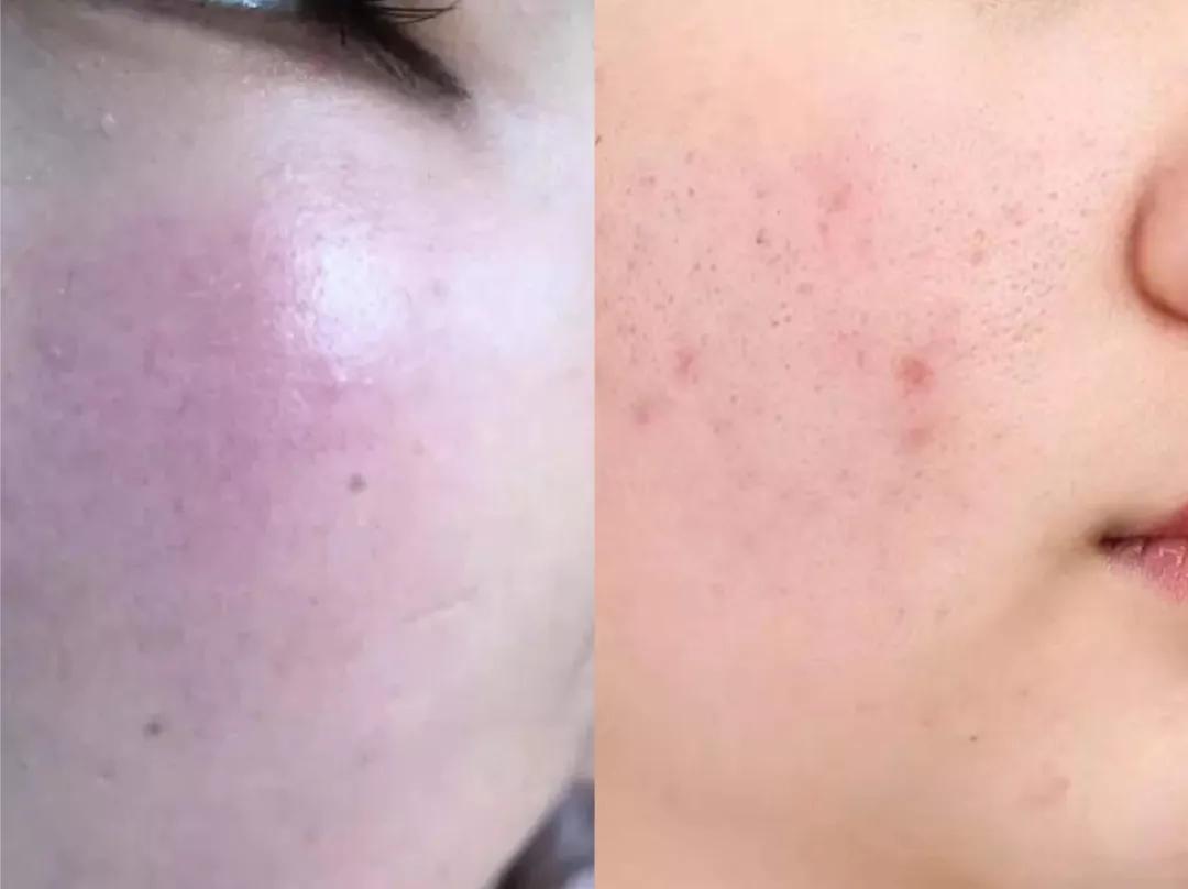 隐藏款改善黑头洗面奶,用完不长黑头和扩大毛孔的洗面奶