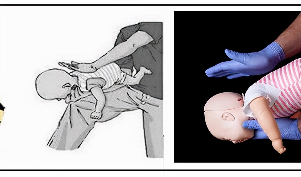 宝宝呛奶怎么正确急救,宝宝呛奶后的急救处理图解
